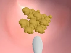 Lojë Earwax Clinic në internet
