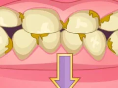 Lojë Bad Teeth Makeover në internet