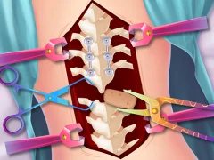 Lojë Anna Scoliosis Surgery në internet