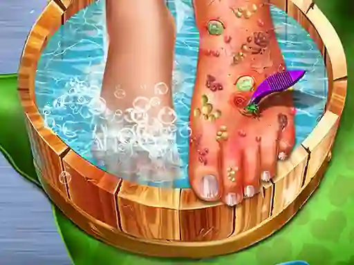 Lojë Feet Skin Doctor në internet
