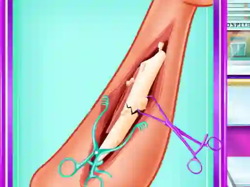 Lojë Ladybug Leg Surgery në internet
