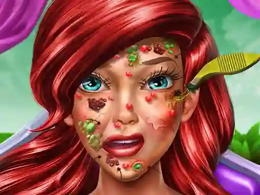 Lojë Princess Mermaid Skin Doctor në internet