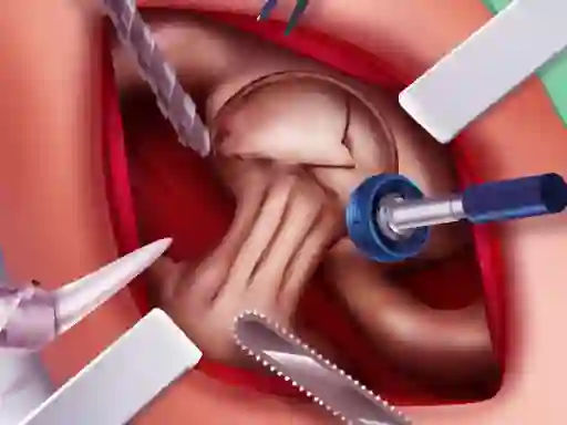 Lojë Princess Hips Surgery në internet